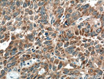 VEGF Receptor 2 Antibody in Immunohistochemistry (Paraffin) (IHC (P))