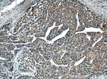 VEGF Receptor 2 Antibody in Immunohistochemistry (Paraffin) (IHC (P))