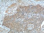 VEGF Receptor 2 Antibody in Immunohistochemistry (Paraffin) (IHC (P))