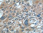 VEGF Receptor 2 Antibody in Immunohistochemistry (Paraffin) (IHC (P))