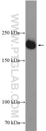 VEGF Receptor 2 Antibody in Western Blot (WB)