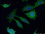 ENAH Antibody in Immunocytochemistry (ICC/IF)