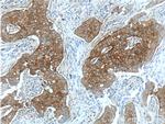 ENAH Antibody in Immunohistochemistry (Paraffin) (IHC (P))