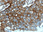 ENAH Antibody in Immunohistochemistry (Paraffin) (IHC (P))