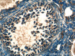 LHCGR Antibody in Immunohistochemistry (Paraffin) (IHC (P))