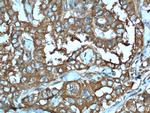 LHCGR Antibody in Immunohistochemistry (Paraffin) (IHC (P))