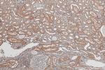 ZDHHC12 Antibody in Immunohistochemistry (Paraffin) (IHC (P))