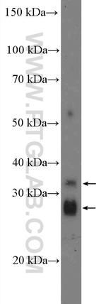 ZDHHC12 Antibody in Western Blot (WB)