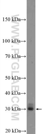 Enkurin Antibody in Western Blot (WB)