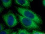 SFRP1 Antibody in Immunocytochemistry (ICC/IF)