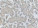 SFRP1 Antibody in Immunohistochemistry (Paraffin) (IHC (P))