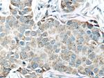 SFRP1 Antibody in Immunohistochemistry (Paraffin) (IHC (P))