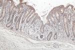 SFRP1 Antibody in Immunohistochemistry (Paraffin) (IHC (P))