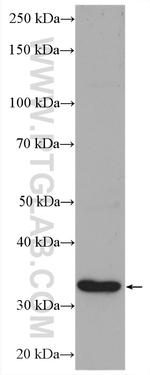 SFRP1 Antibody in Western Blot (WB)