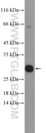 EAF6 Antibody in Western Blot (WB)