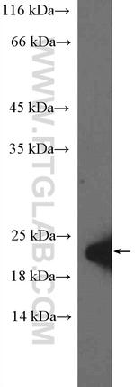 EAF6 Antibody in Western Blot (WB)