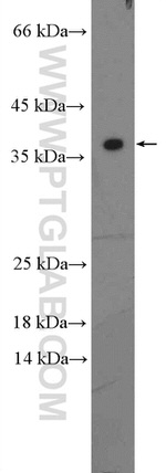 Mitoferrin 1 Antibody in Western Blot (WB)