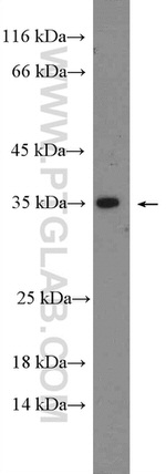 Mitoferrin 1 Antibody in Western Blot (WB)