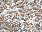 OTC Antibody in Immunohistochemistry (Paraffin) (IHC (P))