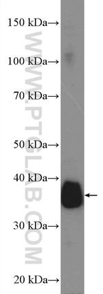 OTC Antibody in Western Blot (WB)