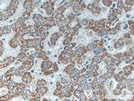 SLC2A9 Antibody in Immunohistochemistry (Paraffin) (IHC (P))