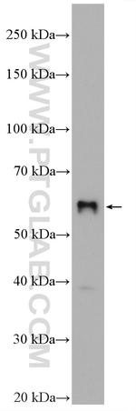 SLC2A9 Antibody in Western Blot (WB)