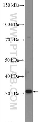 DIO2 Antibody in Western Blot (WB)