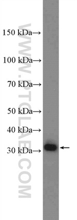 DIO2 Antibody in Western Blot (WB)