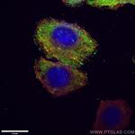 Vinculin Antibody in Immunocytochemistry (ICC/IF)