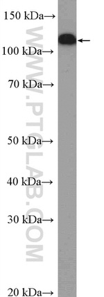 Vinculin Antibody in Western Blot (WB)