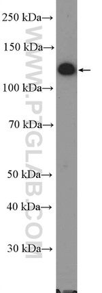 Vinculin Antibody in Western Blot (WB)