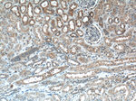 CLTC Antibody in Immunohistochemistry (Paraffin) (IHC (P))