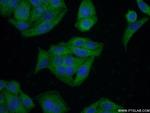 CLTC Antibody in Immunocytochemistry (ICC/IF)