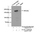 CLTC Antibody in Immunoprecipitation (IP)