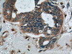 Phospholipase C beta 1 Antibody in Immunohistochemistry (Paraffin) (IHC (P))