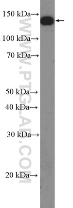 Phospholipase C beta 1 Antibody in Western Blot (WB)