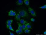 FGF9 Antibody in Immunocytochemistry (ICC/IF)