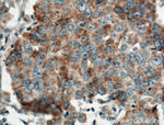 FGF9 Antibody in Immunohistochemistry (Paraffin) (IHC (P))