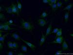 CPT2 Antibody in Immunocytochemistry (ICC/IF)