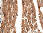 CPT2 Antibody in Immunohistochemistry (Paraffin) (IHC (P))