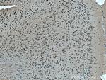 OAT1 Antibody in Immunohistochemistry (Paraffin) (IHC (P))