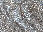 CD55 Antibody in Immunohistochemistry (Paraffin) (IHC (P))