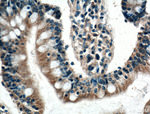 SCF Antibody in Immunohistochemistry (Paraffin) (IHC (P))