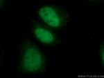 LIG3 Antibody in Immunocytochemistry (ICC/IF)