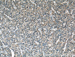 MMP1 Antibody in Immunohistochemistry (Paraffin) (IHC (P))