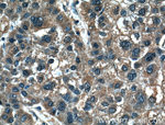 MMP1 Antibody in Immunohistochemistry (Paraffin) (IHC (P))