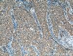 MMP1 Antibody in Immunohistochemistry (Paraffin) (IHC (P))