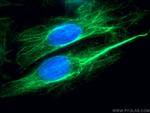 p70(S6K) Antibody in Immunocytochemistry (ICC/IF)