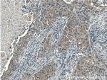 p70(S6K) Antibody in Immunohistochemistry (Paraffin) (IHC (P))