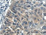 p70(S6K) Antibody in Immunohistochemistry (Paraffin) (IHC (P))